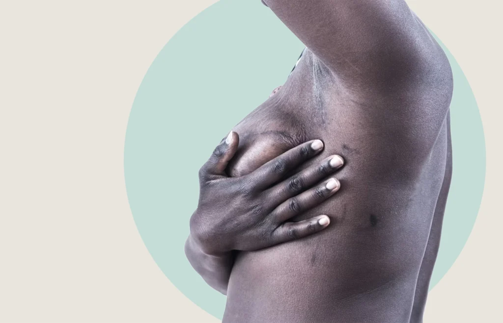 prevenzione tumore al seno