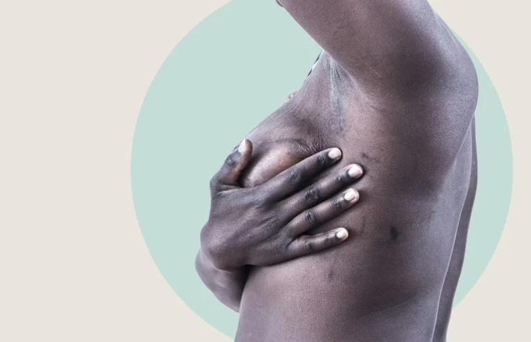 prevenzione tumore al seno