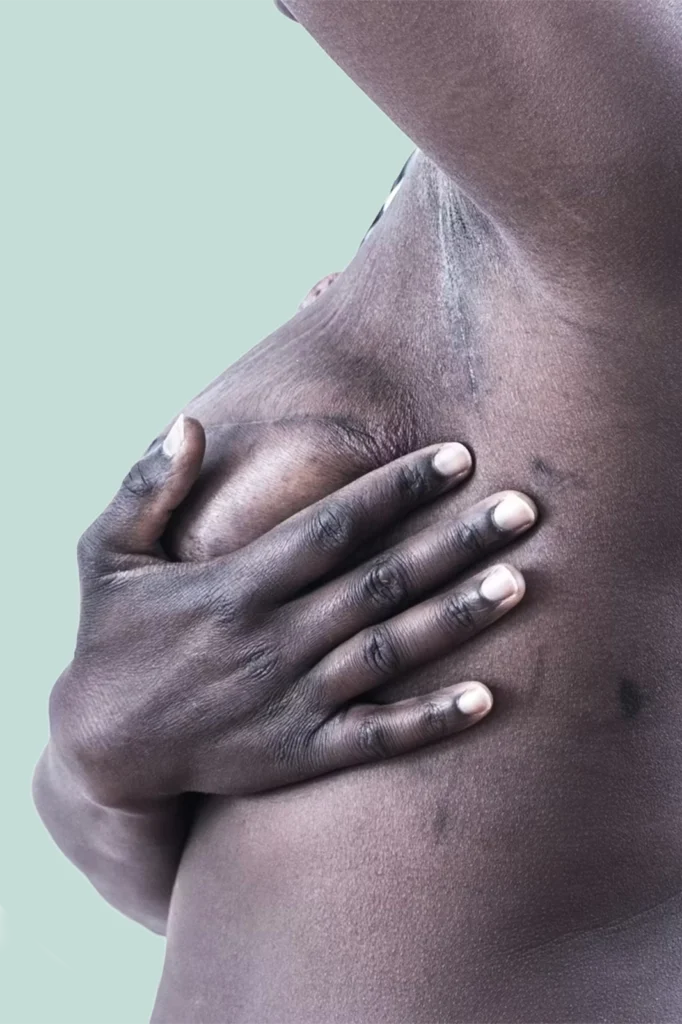 riabilitazione dopo intervento tumore al seno